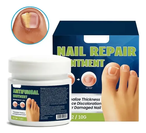 Locion Reparacion Uñas Ataca Hongos Onicomicosis Manos Pies