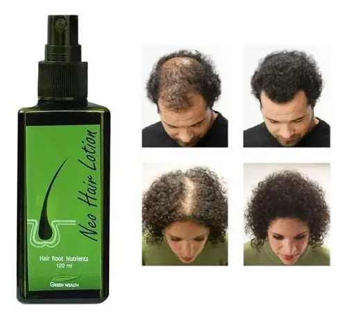 For Neo Hair Lotion Fast Absorbing Natural Hair Recommend