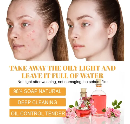 Limpiador Facial Hoygi Con Cúrcuma 100ml Normal Día/noche