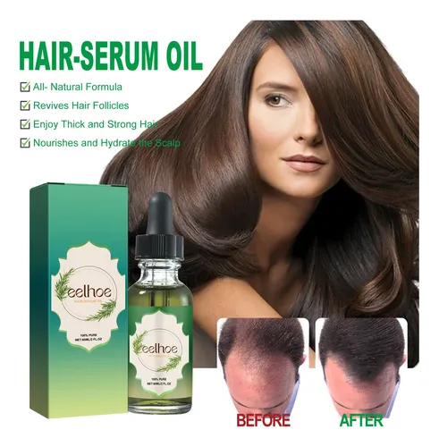 Aceite Capilar De Romero Eelhoe Para Cabello Fuerte Y Grueso