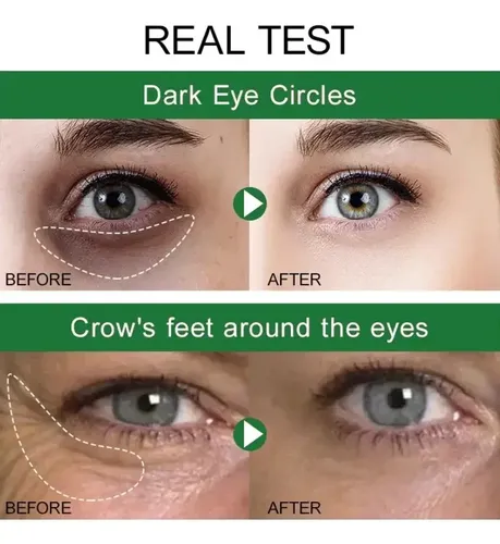 Crema Antiarrugas Antiarrugas De 7 Días Para Ojos Oscuroser