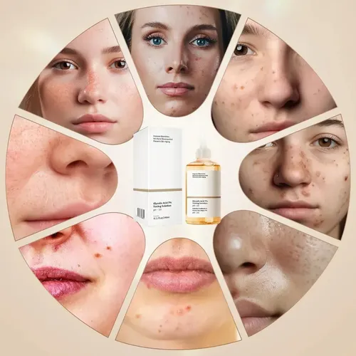 Ss Tónico Exfoliante Sdadcs Con 7% De Ácido Glicólico –