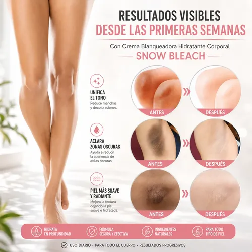 Crema Blanqueadora Hidratante Corporal Snow Bleach Aclarante