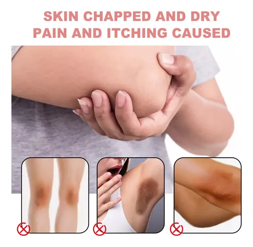 Sérum Corrector Oscuro Para Rostro Y Cuerpo, Blanqueador E H
