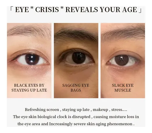 Crema Contorno Ojos Antiojeras Vc+ Ve 30g Revitalizante Normal A Mixta Día/noche