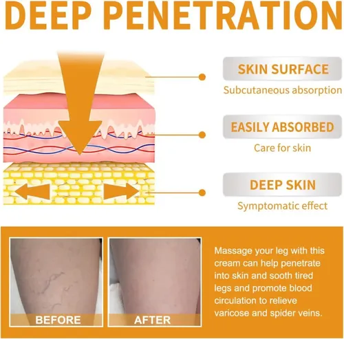 2 Unidades De Crema Milagrosa For Varices Con Vitamina K