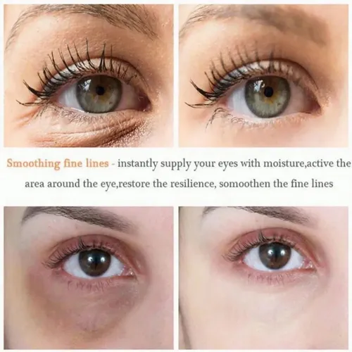 [rx Crema De Ojos Seoul 1988 Con Retinol, 30 Ml