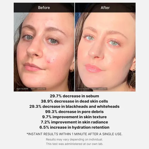 Medicube Exfoliante Ácido Al 21% (aha+bha+ácido Succínico)