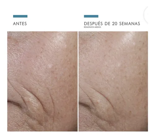 Skinceuticals Ce Ferulic Ácido Ferúlico Con Vitamina C Sérum