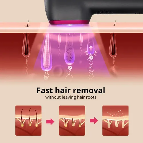 Depiladora Feminine Fast Result Lista Para Usar Buena Compra