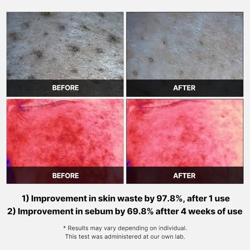 Medicube Almohadillas Red Succinic Acid Peeling Facial