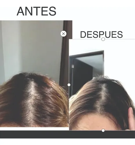 A, Crecimiento De Cabello Peine Láser Caida Cepillo