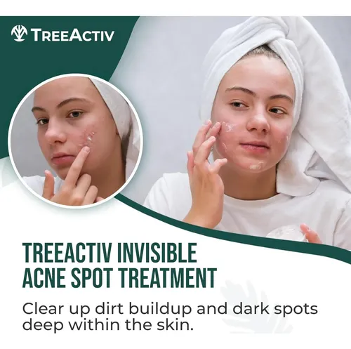 Crema Facial Antiacné Treeactiv Con Ácido Salicílico 15