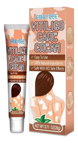 M* Crema Para El Vitíligo Para Reducir Las Manchas *xl