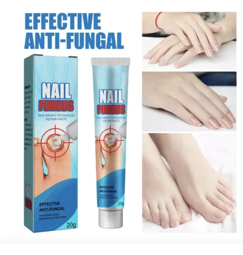 Crema Anti Hongos De Uñas Ataca Onicomicosis Pies Salud Fragancia Herbal
