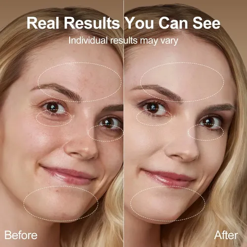 Masajeador Facial Neatlt Con Luz Roja Y Rodillo De Jade 7 En