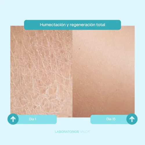 Cera Regeneradora Valca para Piel Seca y Sensible, Con Vitamina A y Omega