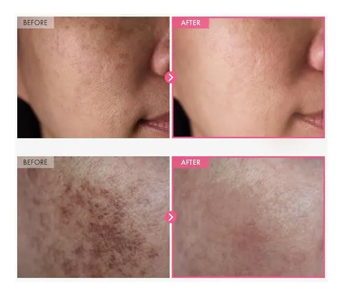 Crema Hidratante Antiarrugas Con Nicotinamida Glicina De Oso