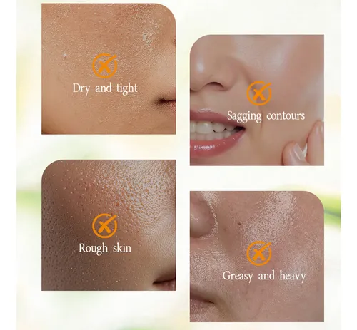 Crema Hidratante Rónica Con Loción Facial Y Corporal De .