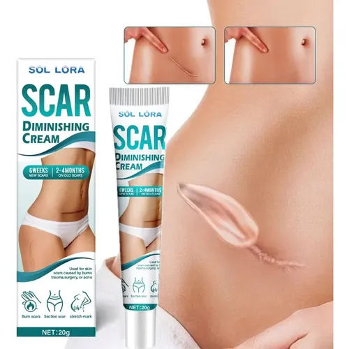 2*crema Cicatrices Reduce Estrías Marcas Cicatrices