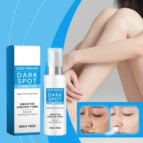 Esta Crema Iluminadora Ayuda A Mejorar La Opacidad De La Gra