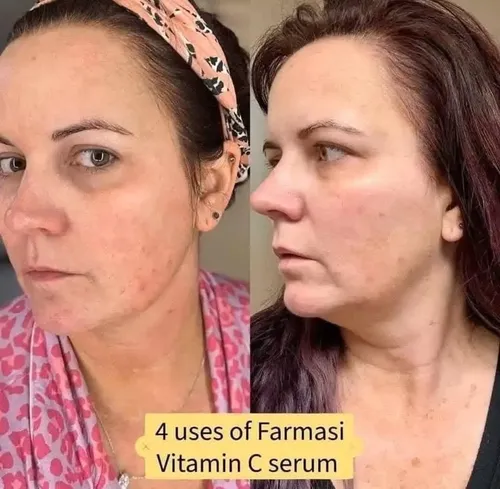 Vitamina C Glow Serum Farmasi, Suero Reductor Manchas Piel Momento De Aplicación Día/noche Tipo De Piel Sensible