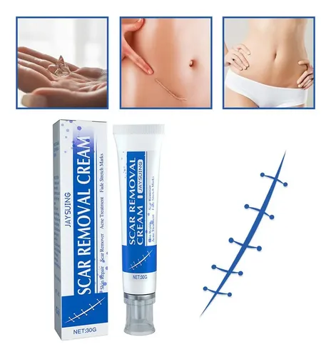 Crema De Eliminación De Cicatrizes%2c Fade Scars Crema R
