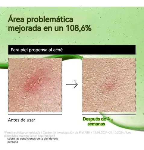 /rr Sérum De Ácido Azelaico Y Ácido Hialurónico Relivio+