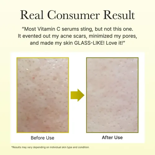 J/ Sérum Potenciador De Vitamina C Con Glutatión De