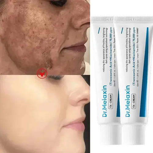 Crema Facial Despigmentante Y Anti Manchas Pack X2 Aurivela