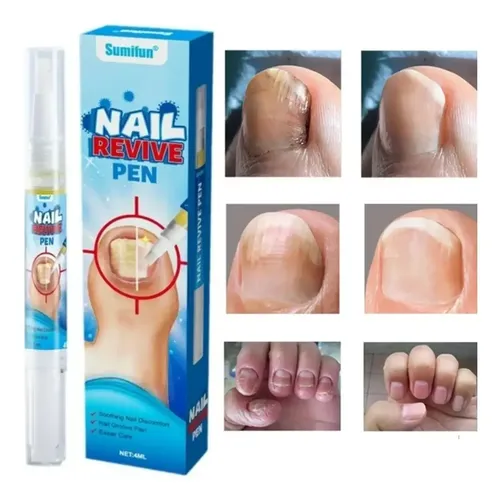 Laca Uña Manos Pies Cura Hongo + Suero Reparador Profesional Fragancia Neutra