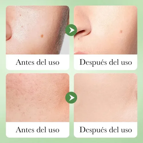 Locion Facial Reparadora Con Centella Asiatica 80ml Todo Tipo De Piel Día/noche
