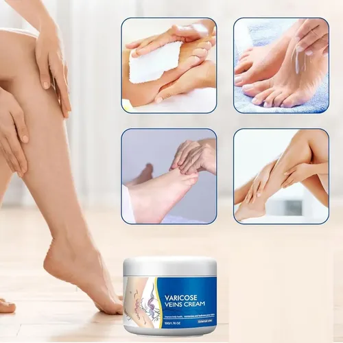 D Crema Reparadora De Piernas Para Venas Varicosas, Crema