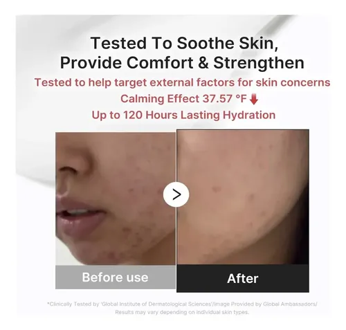 Skin Medicube 3h Relief Cream Reparadora De Acne Rosacea Todo Tipo De Piel Día/noche