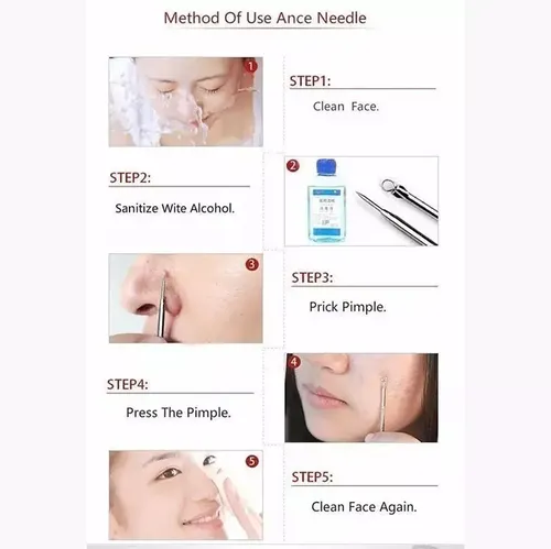 10u Extractor Removedor Acne Espinillas Limpia Comedon 12cm