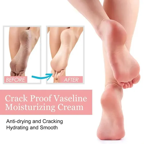 Crema Hidratante Gel Exfoliante Para Pies Y Manos Fd