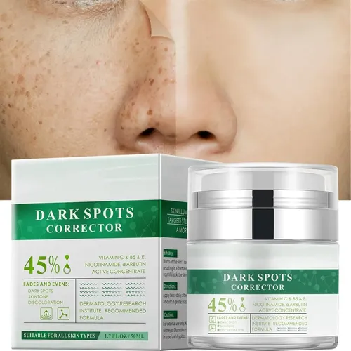 High Quality T; Crema Para Manchas Oscuras En La Cara 50 Ml