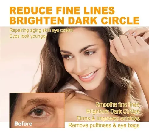 Crema Reafirmante Para Ojos, Elimina Bolsas Y Ojeras.