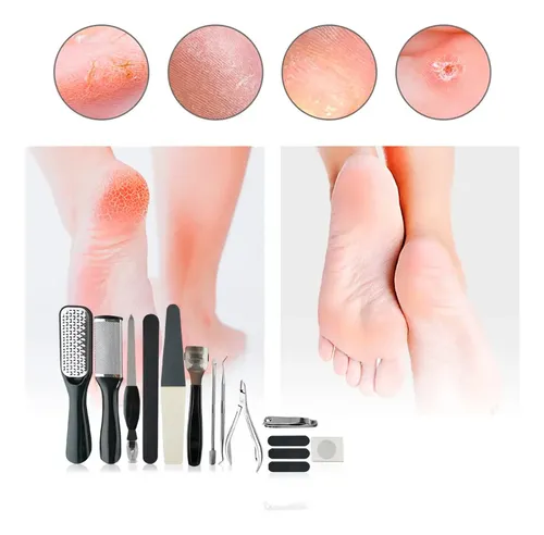 Set Para Pedicuria Podologia Callosidad Durezas Escofina
