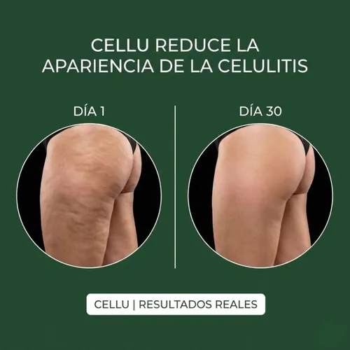 2 Cremas Para Masajes Anticelulitica 210ml Fragancia Neutra