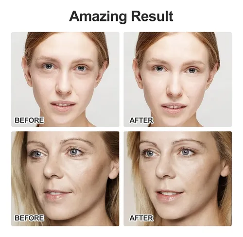 Masajeador Zminrn Terahertz Gua Sha Facial Tool