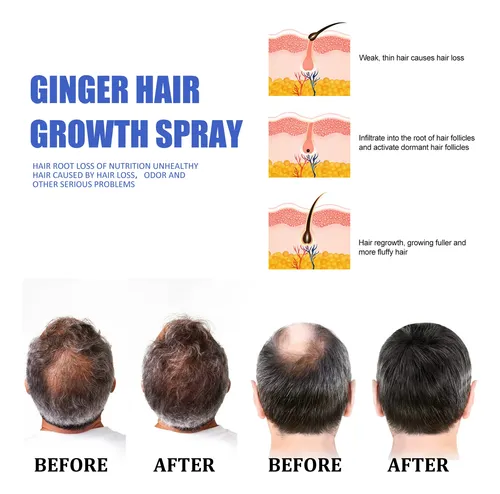 Spray Para El Cabello Con Jengibre Eelhoe, Nutritivo Y Suavi