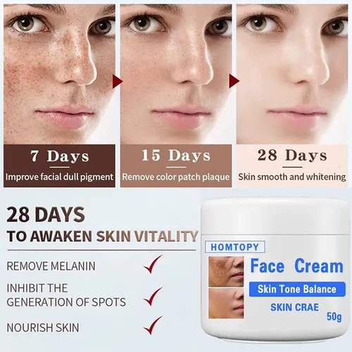 Crema Iluminadora Única Para Manchas Faciales, 50 G, Melasma