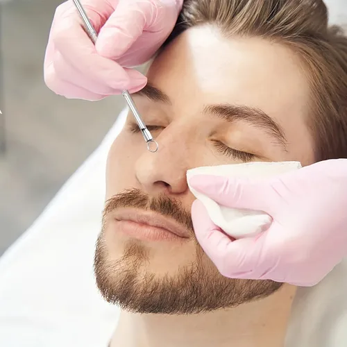 Set Profesional Ultrapreciso De 6 Piezas: Pinzas Para Acné I