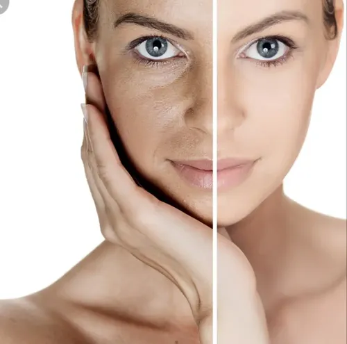 Arvensis Mandelico 15% Peeling Facial Antiacné Y Manchas