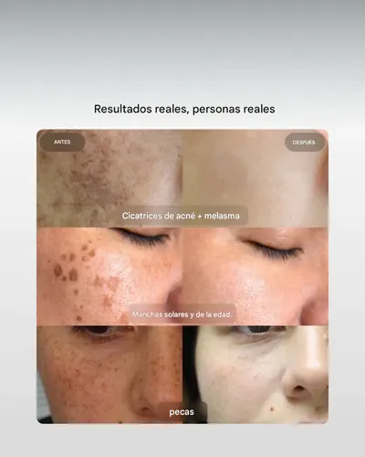 Eliré Sérum Corrector Manchas Oscuras Melasma 30ml