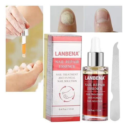 Crema Reparacion Hongos De Uñas Ataca Onicomicosis Pies