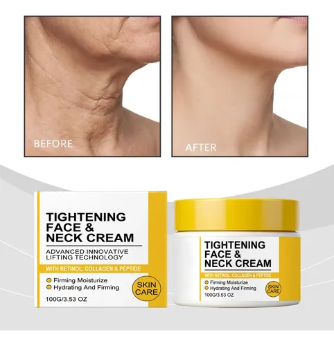La Crema Para El Estiramiento Del Cuello Y El Anillo Nutre P