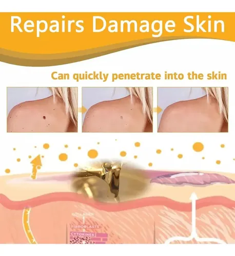 A 6pcs Tag Recede Bee,tag Recede Bee Spray For Mujeres Y