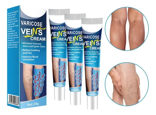 Crema Varices Estrías Descanso Piernas Post Jornada Larga